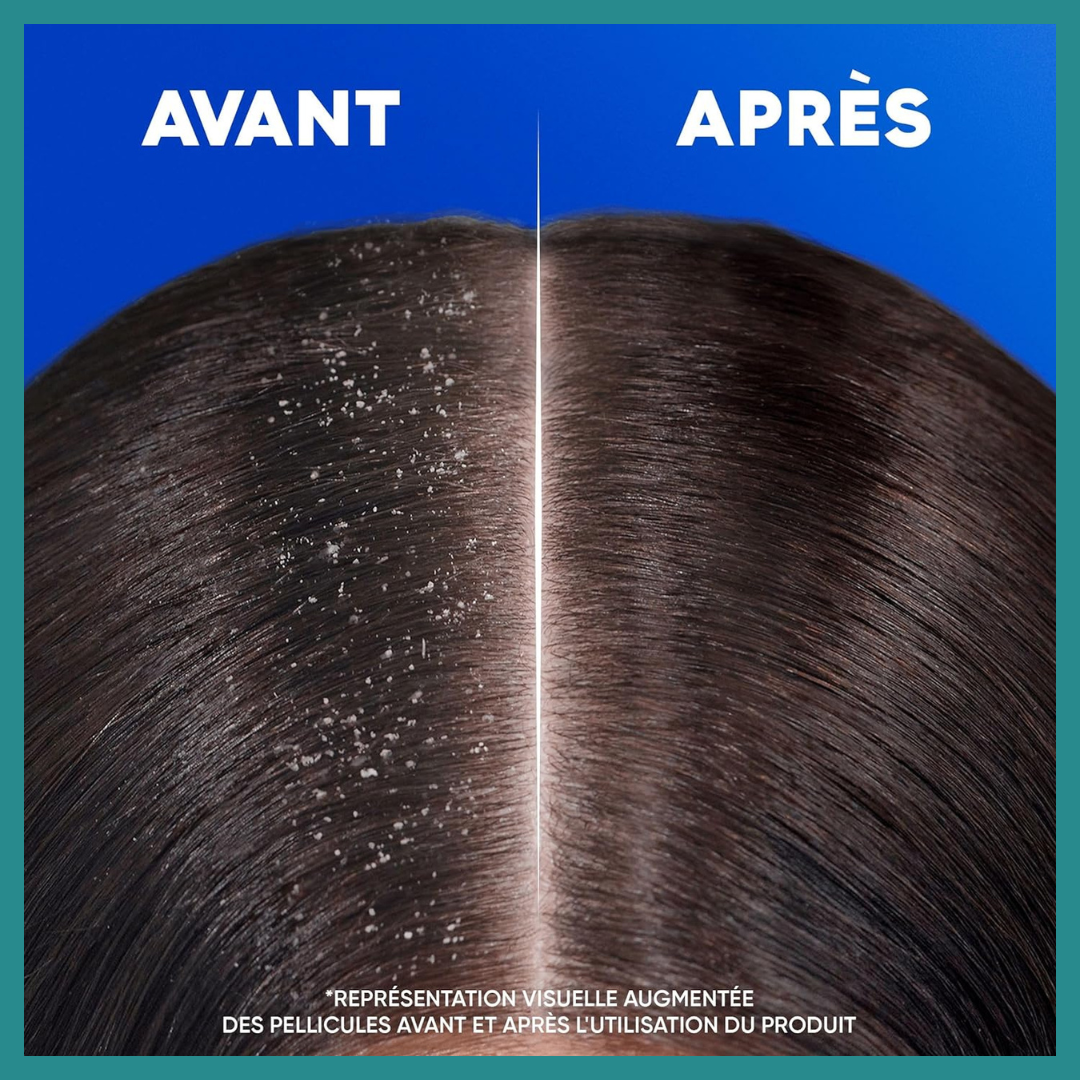 Head & Shoulders Intense Hydration – Le Shampoing Idéal Pour Un Cuir Chevelu Sain Et Des Cheveux Nourris