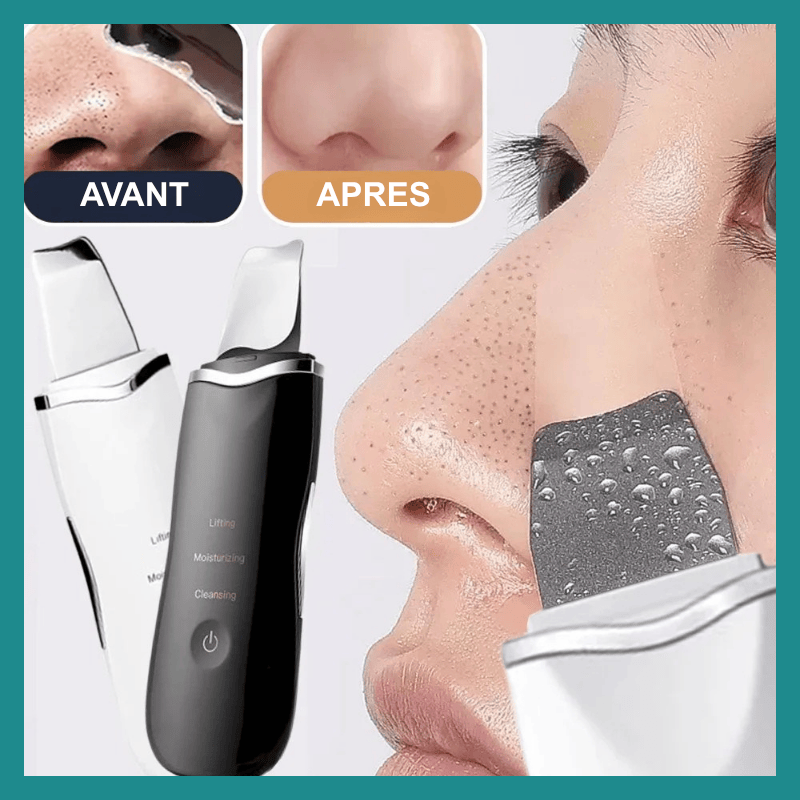 Scrubber ya loposo ultrasonique, Remover ya ba points noirs, Nettoyage ya elongi ya mozindo, Levage ya ba pores ya acné, Spatule ya elongi, pelle ya nettoyage